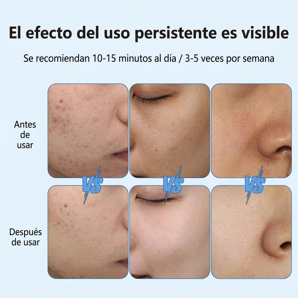 Mascarilla LED de silicona con 8 modos de luz y opción para cuello