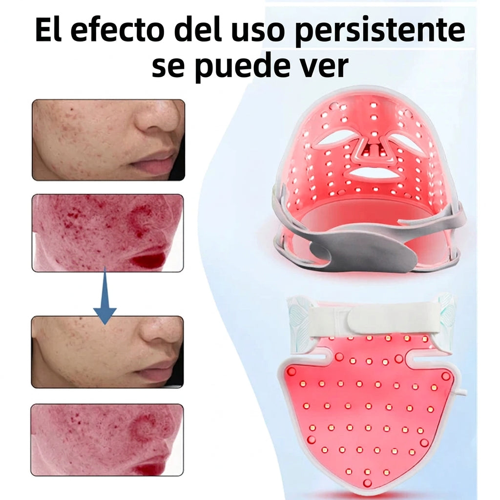 Mascarilla LED de silicona con 8 modos de luz y opción para cuello